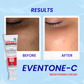 Eventone-C Cream - Skin Whitening & Brightening Formula (Both for Men & Women)