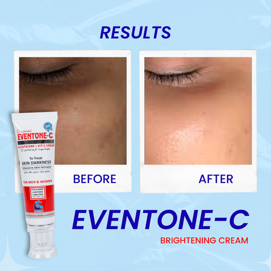 Eventone-C Cream - Skin Whitening & Brightening Formula (Both for Men & Women)